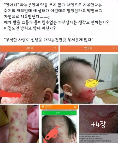 혐) 부모가 대가리가 나쁘면 생기는 일